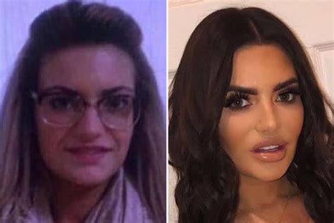 megan before surgery love island|megan barton hanson before surgery.